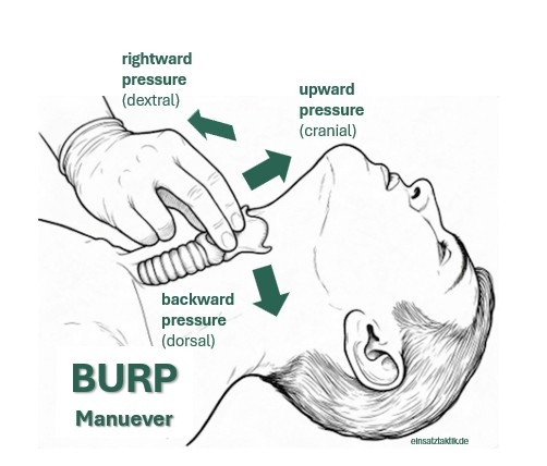 BURP
