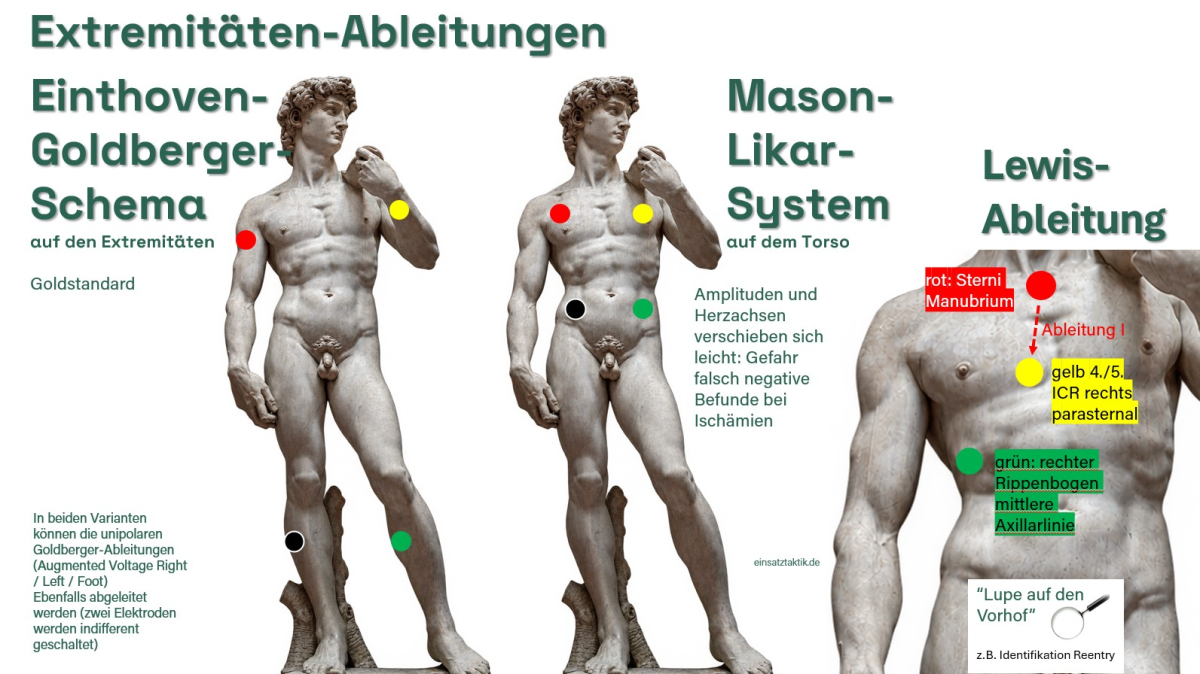 Extremitätenableitungen