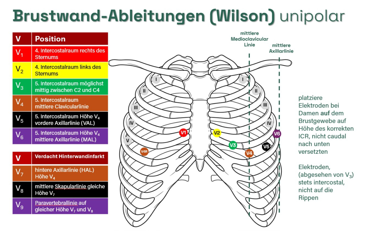 Brustwandableitungen