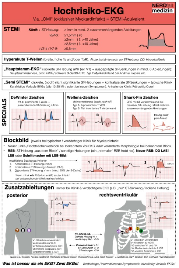 Hochrisiko EKG