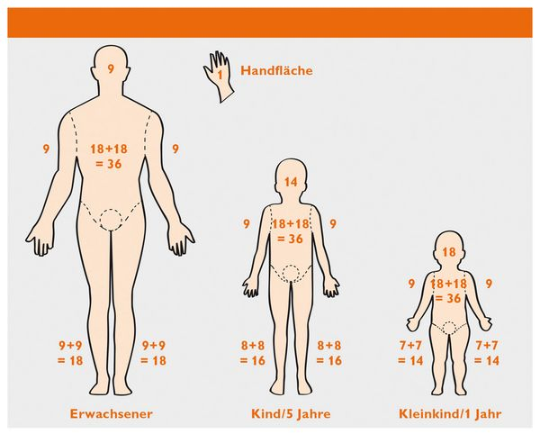 Wallace Regel Erwachsene und Kinder